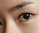 <b>서우</b> 앞트임 잘됐넹?!! 연예인 앞트임~!!