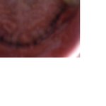 20살 꽃다운나이에 이빨 12게없이 사는얘기 ㅋㅋㅋ