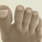 <b>무좀</b>때문에미쳐..<b>무좀</b>치료까지했습니다.