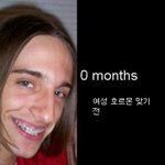 여성 호르몬 10개월 맞은 남자의 <b>변화</b>