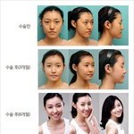 <b>성형녀</b> 어때요?