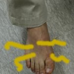 <b>무좀</b> 때문에 정말 살 수가? 아 <b>무좀</b> 너무나 괴롭히네요~