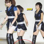 <b>발목</b>이 삐긋한 꽈당녀 '카라' 한승연