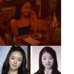 연예인 성형외과 유명한 곳, <b>서우</b>가 성형한곳은?