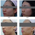 <b>낭랑</b> 18세에게 주근깨가 뭐란 말입니까 ㅠㅠㅠㅠ