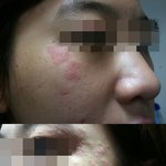 ma* 샘플쓰고 뒤집어진 내 얼굴 ㅠ ㅠ