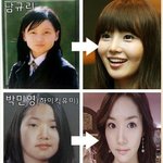 주걱턱이랑빠이하고 새롭게 태어나고싶은....욕심많은...20대처자...
