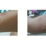 병원에 치료받으러 갔다가 상처를 입고 왔습니다.