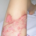 ★편의점 관리소홀로 인한 허벅지화상 너무억울해요★