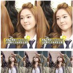 이마 <b>볼록</b>해진 소녀시대 제시카, 일본에서!