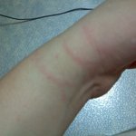 아무도 안건드린 손목에 손가락자국이..(사진有)