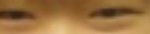 쌍꺼풀수술한후 시력이 나빠지나요?