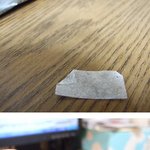 발바닥에 유리 박혀 정형외과 수술대에 올라봤어요.