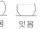 임플란트 마음에 안 들어요ㅠ