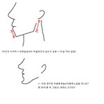 주걱턱, 긴턱, 하관