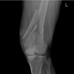 <b>택시비</b> 안내고 내리는 승객 붙잡다가 다리 심하게 부러진 <b>택시</b>기사...