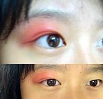 아....모기새끼....ㅠ_ㅠ