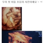 23살 두아이엄마의 출산이야기