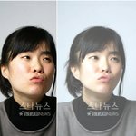 ○●○● 성형외과 판 *○pen  ○●○●