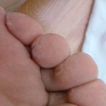 ★★도움요청★★ <b>반스</b> 사진첨부( 발이 썩어갑니다............