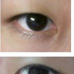 쌍수할까 고민중이에요 사진有