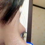 눈을 향한 모기의 습격 사진有