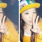 브아걸 손가인 쌍커<b>풀</b> 수술 하면? :-)