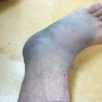 군에서 다친 사람이라면 한번쯤 겪는 일