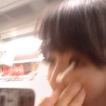 렌즈<b>통속</b>의 위험한물건 !횽들 조심하셈[스압]