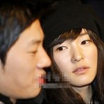 차수연 쌍꺼풀<b>수술</b> 전과 후