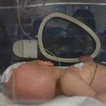 <퍼온글> 8개월 산모 뺑소니교통사고,가해자 그냥 풀려남 (아고라서명