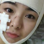 <b>붕대</b> 감아도 살아있는 미모 한지우