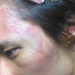 모르는사람에게 <b>폭행</b>을 당했습니다.