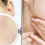 피부는 몇 살 일까요?ㅠ 간단한 자가 테스트 해보세요~ㅋ 그리고 <b>설화</b>