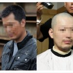 연예인들의 스트레스성 탈모는 악성댓글과 지나친 관심에서 오는 부담감때문...