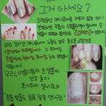 ★손톱,발톱도 숨을 쉴줄 안다구요! 1.4.3!!!!!!!!!!...