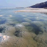 소금이 여드름을 극복한다?? 소금으로 이겨내는 여드름 극복법!