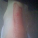 베어파우 부츠신고 발이 이렇게됐어요ㅠㅠ