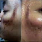 <b>오라클</b> 피부과 원장이라는 사람이,,,,수준하고는 ㅉㅉ