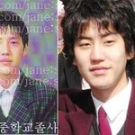 쌍꺼풀 재수술 인증한 <b>슈주</b> 규현