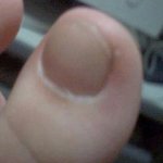 (사진/有) 원빈<b>발톱</b>생김 인증샷 !!!