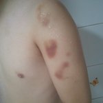 집단폭행당한 우리 아들..(사진有) 가해자에 대한 <b>처벌</b>