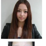 쌍커풀 수술 대박난 연예인