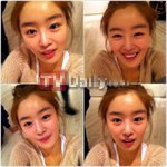 '<b>볼록</b>튀어나온 이마 자랑하는 한선화'