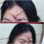 [사진]<b>폭행</b> 사건입니다만... 봐주세요....