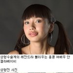 <b>의학</b> 기술의 승리, 안젤라 베이비 성형 전vs 후