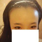 ((사진有))저보다<b>이마</b> 넓으신분? 없음