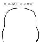 (그림추가)<b>돌출</b>입수술 후 후회하고 있습니다ㅠㅠ 누구 아시는 분 없으신가요