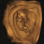 내 아기 <b>민경</b>이에게 처음으로 쓰는 편지