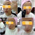 피부고민,, 어떻게 해결하시나요?